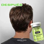RegrowCapilar® - Kit de Regeneración Capilar Microinfusión - Tratamiento Capilar