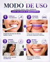 SmileKit - Tiras Blanqueadoras Dentales