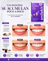 SmileKit - Tiras Blanqueadoras Dentales