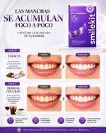 SmileKit - Tiras Blanqueadoras Dentales