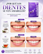 SmileKit - Tiras Blanqueadoras Dentales